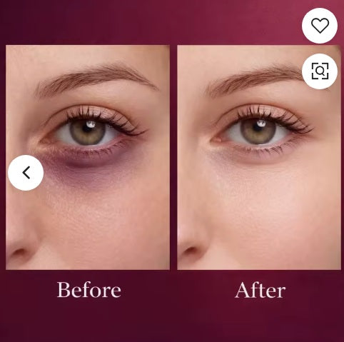 For Dark Circles under the eyes Calcium Dark Spot Eye CreamFade Dark Circles Instantly Lift & Firm Sagging Skin Boost Collagen Production